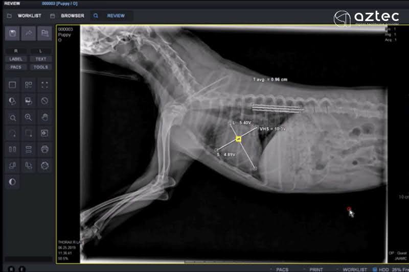ภาพผลเอซเรย์การวัดวัดขนาดของหัวใจ จากโปรแกรมสําหรับแผ่น DR ยี่ห้อ PIXXGEN